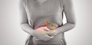 Penyakit GERD anatomi manusia yang menunjukkan aliran balik asam lambung dari perut ke esofagus