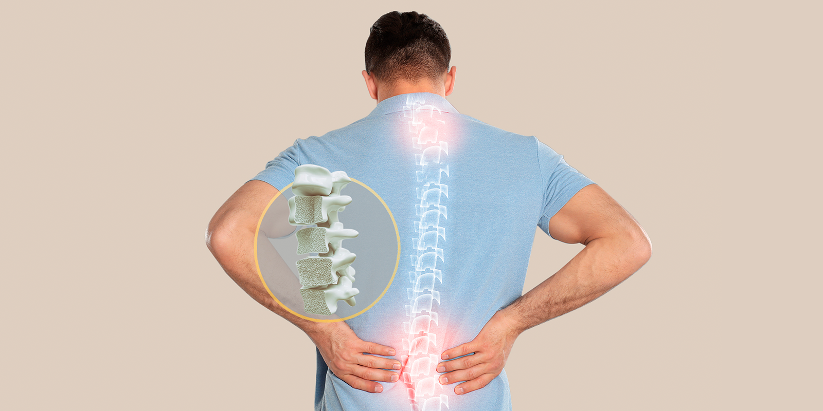 Memahami Osteoporosis: Penyebab, Gejala, dan Cara Mencegahnya